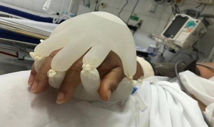 Heartbreaking Photo Shows ‘Hand of God’ Created by Nurse For Covid Patients Suffering in Isolation